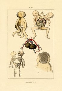 Freak, 1833-39 alkotó: French School